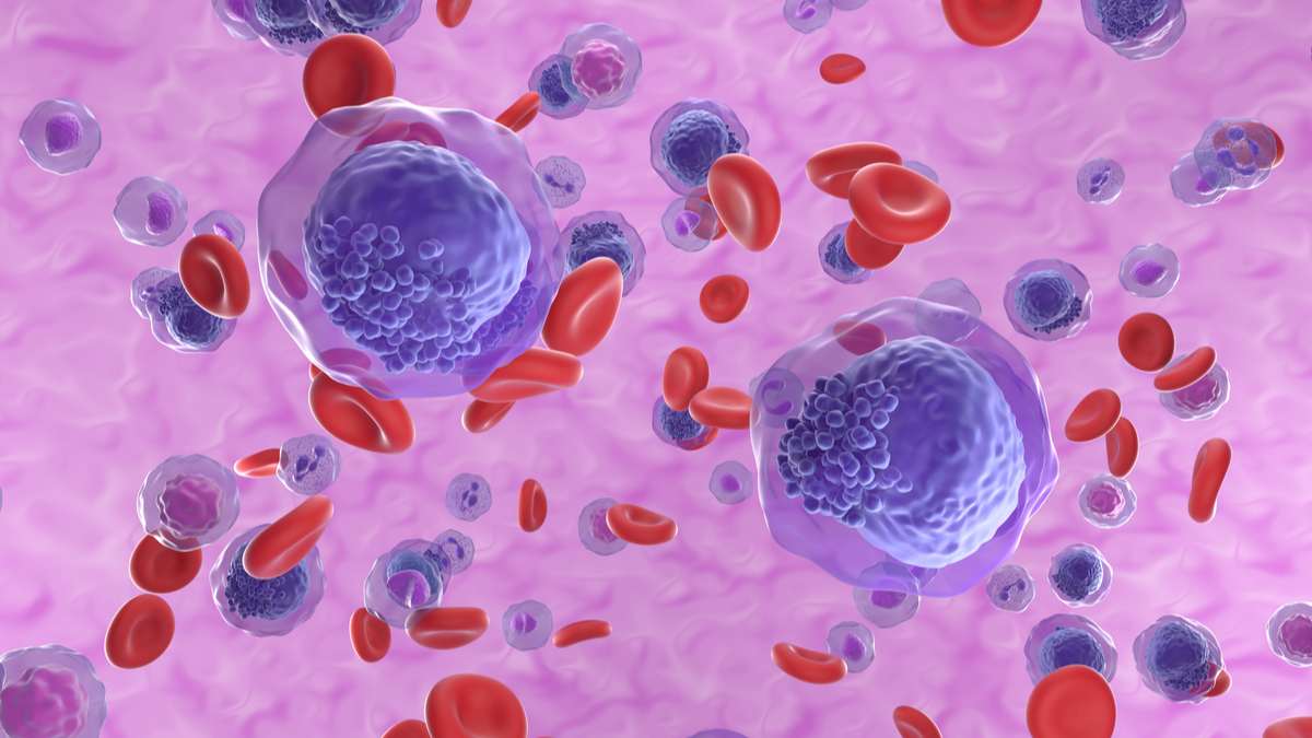 celulas-cancerigenas-leucemia